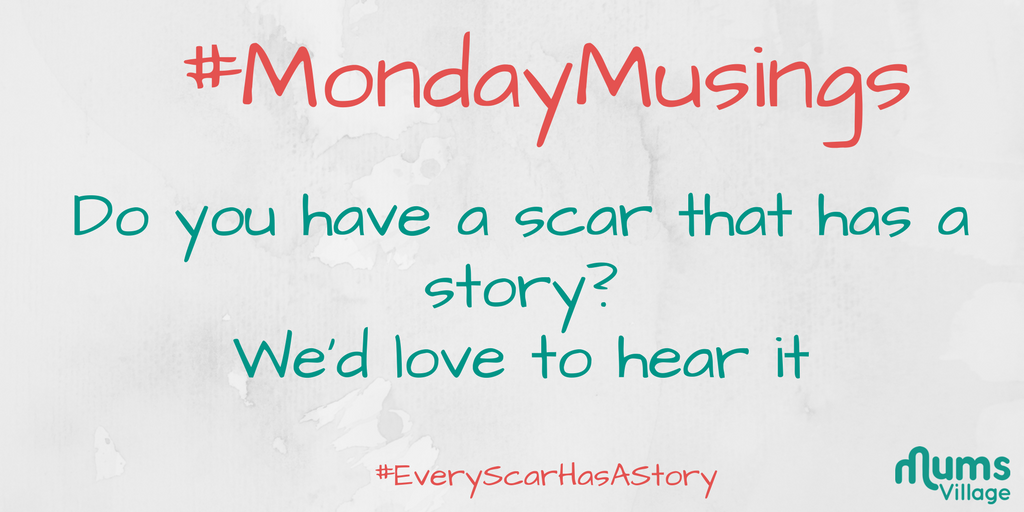 malaicaofficial's tweet photo. Do you have a scar that has a story?
We'd love to hear it today.
#EveryScarHasAStory
#MondayMusings
#MondayMotivaton
#biooilnewlook https://t.co/yuXdRkCNsb