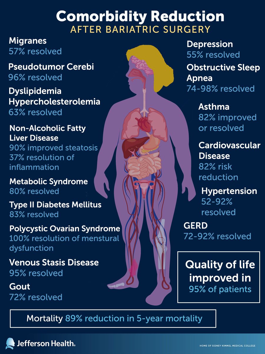 Jefferson Health New Jersey on Twitter "Weight loss surgery can