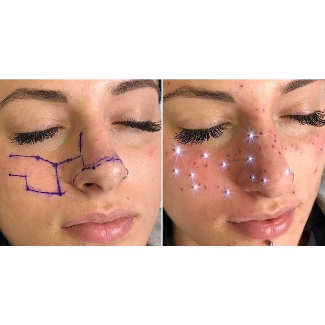 PlatosOakville's tweet photo. So, #astrofrecks are totally a thing. Would you get a constellation tattooed on your face? #style #trends https://t.co/9SHbkqnRBL https://t.co/qwtKTzCOBc