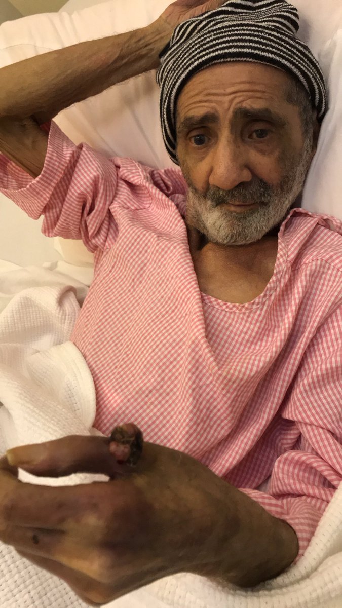 Lolly13338716's tweet photo. @fayez_malki المريض صالح محمد النفيسه يعاني من مرض سرطان الجلد وهو في مستشفى الحياة الوطني ولا يوجد له علاج ف المستشفى ونحتاج قبول ف مستشفى مدينه الملك فهد او التخصيصي والرجاء المساعده التواصل:0557834445 https://t.co/our1jbpy61