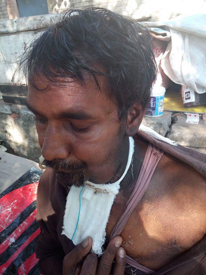 chandanrana_inc's tweet photo. #HelpCancerPatient
Min of Rs100/- won't thin up your pockets but will certainly #SAVEaLIFE
A RICHSHAW puller has been suffering from MOUTH CANCER for the past 4 months
For Donations,
Contact Mritunjay:8050190861 OR visit patient at Sec-15 parking (opp. Gopalz) Chandigarh https://t.co/5PE0o8v9IT