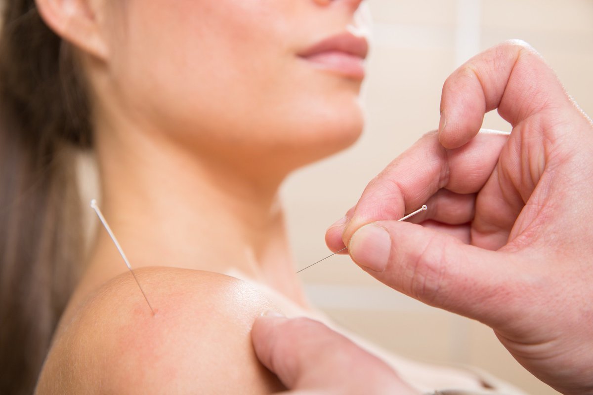 DrDunning's tweet photo. 6 months ago, the New Jersey Attorney General opined that dry needling was not in PT scope of practice; however, 5 days ago, S3591 &amp; A5256 Bills were introduced to NJ legislature in an attempt to reverse this situation. Well done @APTANJ DN Task Force! https://t.co/zJNcCSYVeK https://t.co/rgh8GHMirN