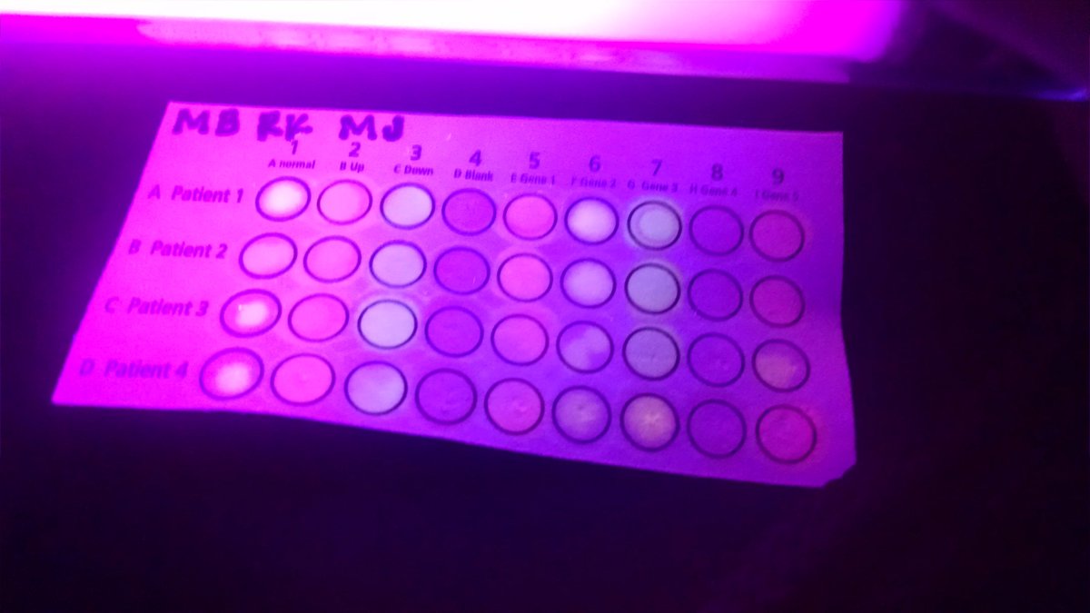 PHSBiomedJobe's tweet photo. MI students using a microarray to test for gene expression in cancer vs normal cells. #PLTW https://t.co/NVcygIKuwI