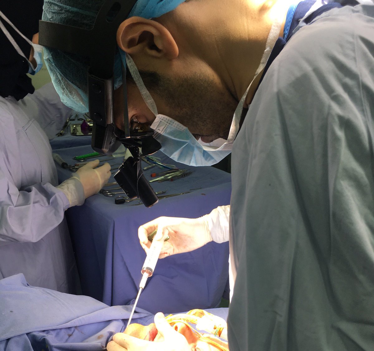 drnabilfakih's tweet photo. Facial Makeover Surgery: is to rejuvenate all the face in one surgery: Superior Blepharoplasty, Inferior Blepharoplasty with Fat Transposition, Neck Liposuction, Facelift, Necklift, Fat Transfer, Buccal Fat Pad Removal, SNIF 4wrinkles, Lip Filler #facialmakeover #plasticsurgery https://t.co/NpsdUsEW3t