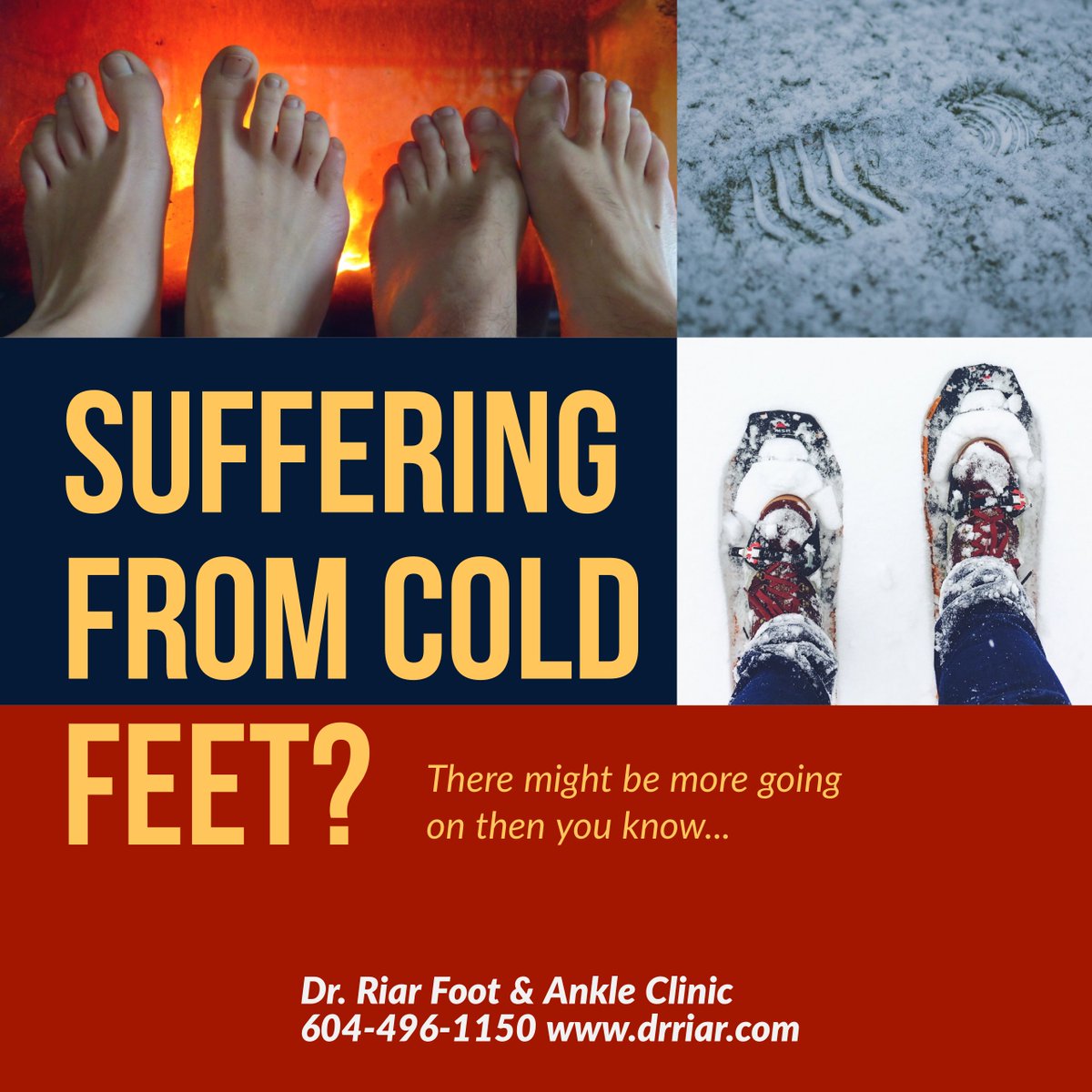 #Coldfeet Poor blood flow in the #legs/#feet such as peripheral vascular disease #PVD Some medications constrict blood vessels #hormonalabnormalities #hypothyroidism #adrenalinsufficiency #nervedisorders peripheral neuropathy #fibromyalgia #autoimmunedisorders Visit a #Podiatrist