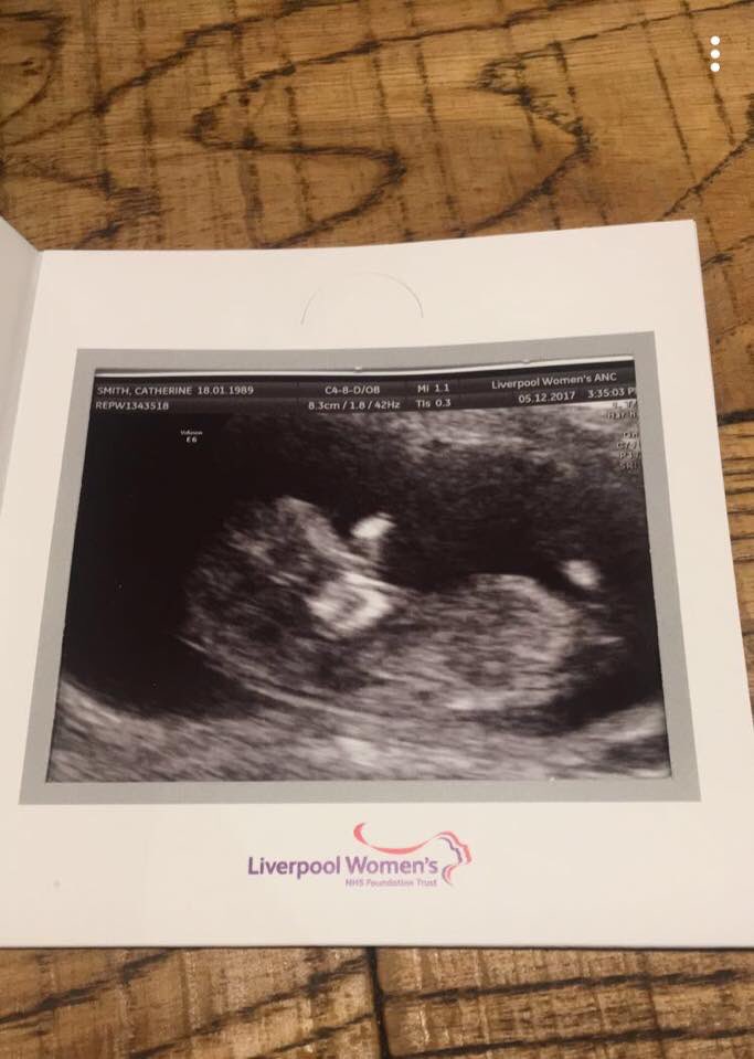 CatherineS89's tweet photo. My little bean due 25th June 😍😍😍 so in love already 🤰👪❤️ https://t.co/Hdq3cAZndK
