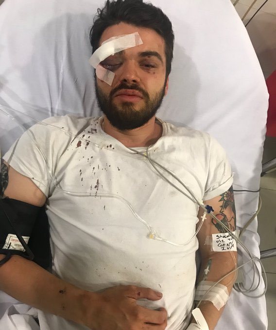 Toda la solidaridad con los colegas de <a href="/CiervosPampas/">Ciervos Pampas RC</a>. Repudiamos el ataque homofóbico sufrido por Jonathan Castellari.