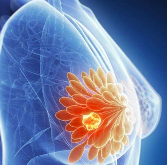 farmasetika_com's tweet photo. Verzenio, Obat Baru yang Dapat Mengurangi Ukuran Tumor Pada Kanker Payudara https://t.co/tAg7XSjDHJ https://t.co/ZLwnNv7C3X