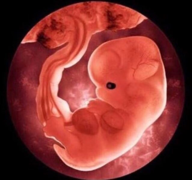 Se habla de "abortos en condiciones inhumanas", cuando lo inhumano es el #aborto en sí mismo. 
#SiALaVida