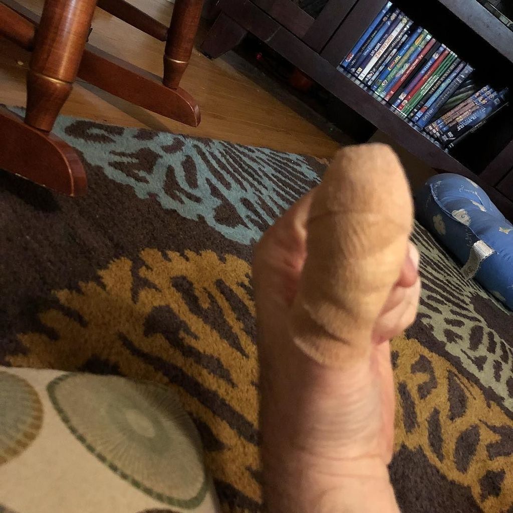 bigguyinabowtie's tweet photo. So chopped off the end of my thumb tonight! #deadfinger https://t.co/OhaWhN0oA1 https://t.co/zrhXJFsomg