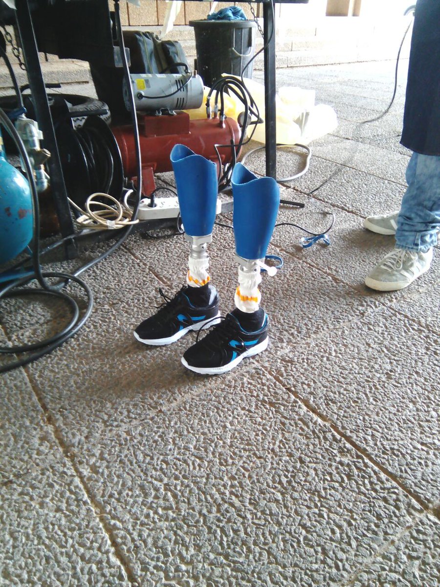 RMAssurance's tweet photo. Ten-year-old George Baloyi received two prosthetic legs, sponsored by RMA, at today's event for people living with disability hosted by @CityofJoburgZA. George's new legs were crafted on site an specially tailored for him. There were smiles all around! #JoburgDisabilityAwareness https://t.co/gfyjDbPtvn