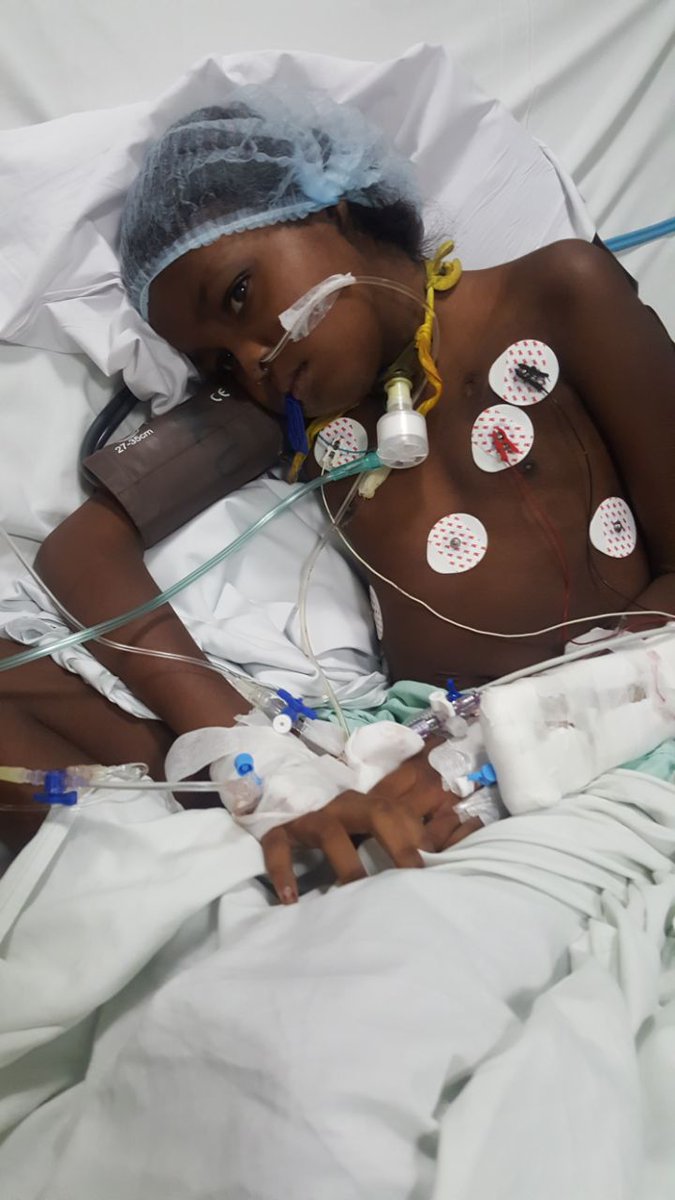 ArishkumarFan's tweet photo. #MedicalHelpforBabyArchana #NeedHelp #saveLife   #GlobalHospital #BabyArchana @rj_rofina @i_Arishkumar @johnmediamanagr 

https://t.co/wfUmVJ9Ze1

A/c. Details: Prabhala Subash. A/c No. 20321819346 SBi, Shrinagar colony Saidapet branch, IFSC CODE: SBIN0011655 https://t.co/ixhYue9njk