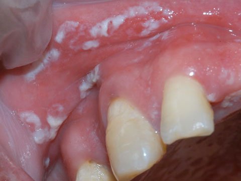 IGDPDentist's tweet photo. 5 Ways Diabetes Can Affect Your Mouth 
https://t.co/QrnSqhcCKz https://t.co/dv6SOCZ5Bb