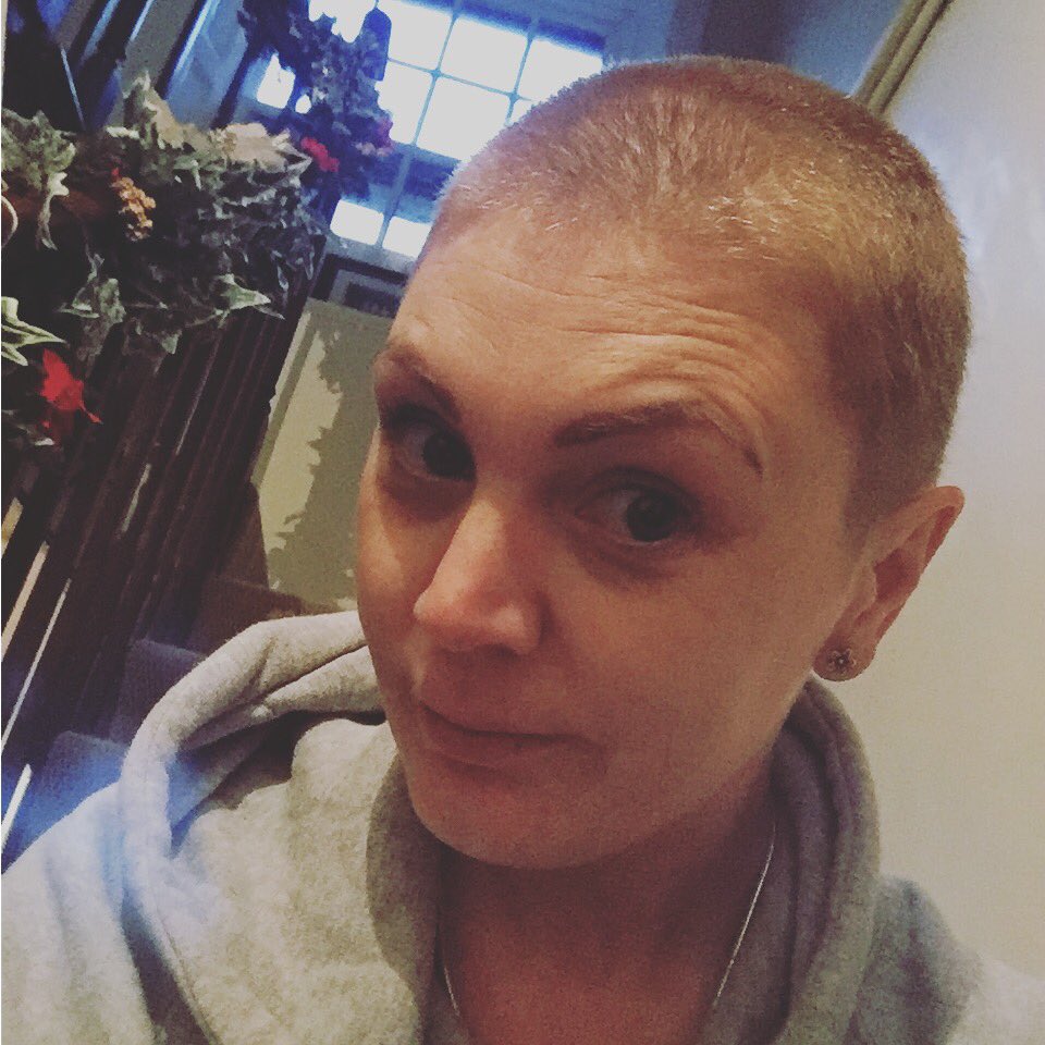 MightyARQuin's tweet photo. Grade 2 all over ready for my radiotherapy Monday.. do you think I could join the Royal Marines now @antmiddleton ? #bootneck #hannahsnell https://t.co/Vc7AIqPMMi