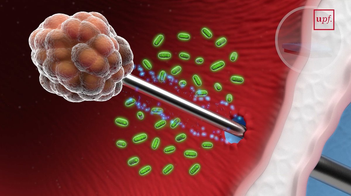 UPFBarcelona's tweet photo. #NeedleSafe to prevent collateral infections in the detection of prostate cancer https://t.co/7dR460lD3Z #UPFResearch #360UPF https://t.co/vRjXmnnCaM
