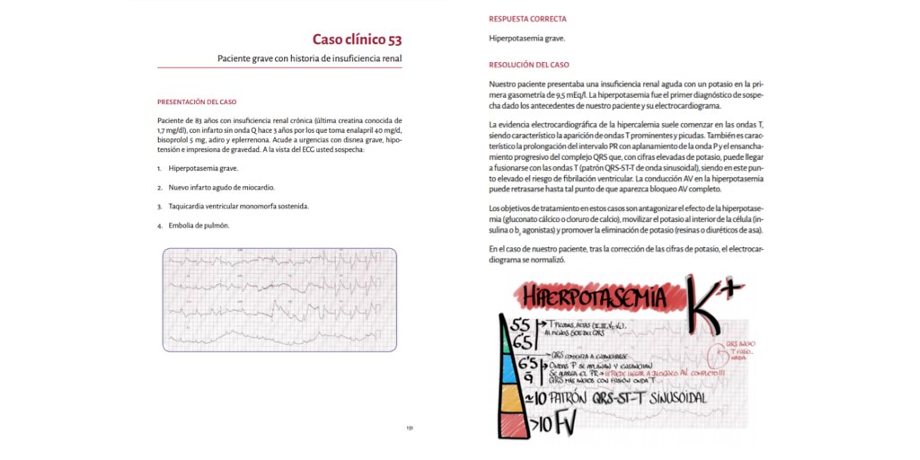 ¿Ya tienes el libro electrónico con los casos ECG presentados a concurso en el Congreso #eCardio17? 

Descárgalo gratis en ow.ly/SDT930h1rkW