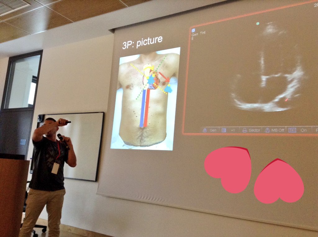 UltrafestMB's tweet photo. @ngorenjak on focused cardiac ultrasound - #F❤️CUS https://t.co/RXAVsLxlPl