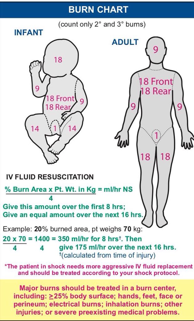 Infant Burn Chart