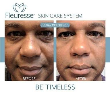 BecomeTimeless's tweet photo. #beautytips #beauty #beautytips101 #beautyblogger #beautytipsshop #beautytipsandtricks #makeup #beautytips4you #fashion #microblading #beautytipsters #beautytipsbysandra #love #beautytipsluana #melbourne #beautytipsbysimona #beautytipscollectionnaturalbeautys 
Dm US! https://t.co/EQ2KqNPL63