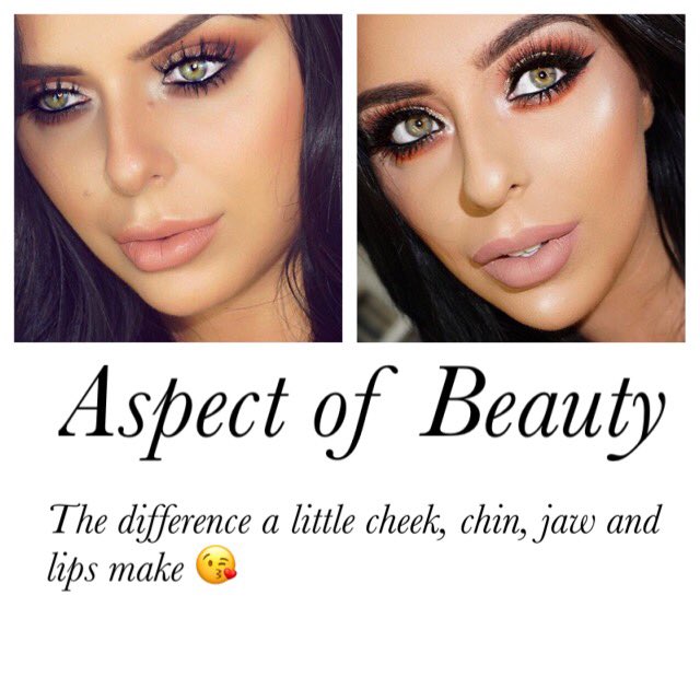 almedicalwell's tweet photo. Achieving your idea of perfection takes time, everyone’s desires are individual. Patience pays off #chin #jaw #stunner #lips #pout💋 #vycross #juvederm #medical #experience #knowledge #workingtogether https://t.co/CUlw2ieCpe