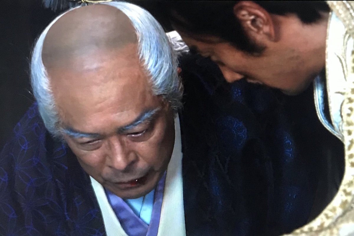 迷人 Q太郎 En Twitter 総白髪は剃ったら肌色 そうなるとあの総白髪もオシャレ染め ﾟoﾟ