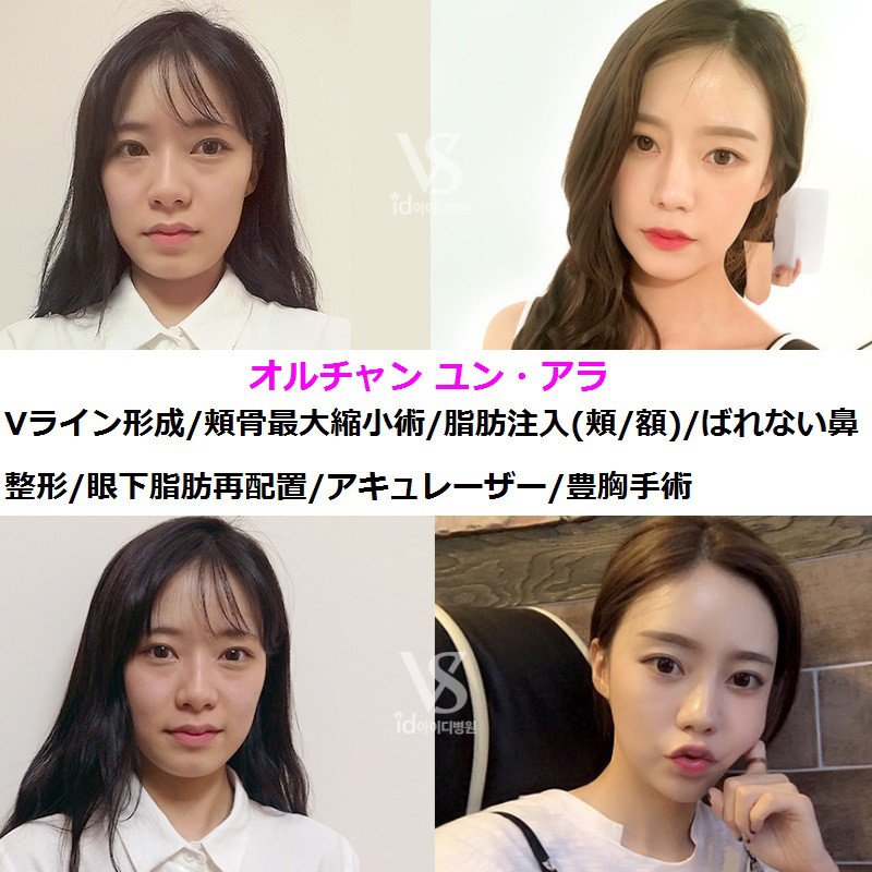 整形ツアー Twitter Search Twitter