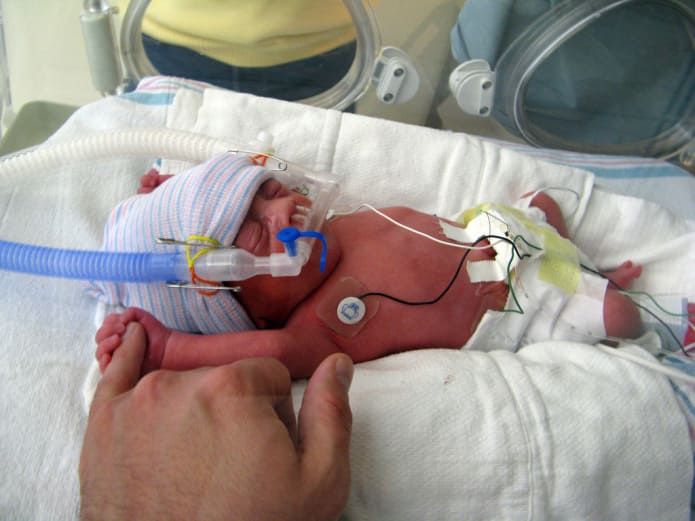PinCrowdFunding's tweet photo. Help Baby Allen For His Intestine Transplantation @ceoguruprasad https://t.co/oyCODl1ci2 https://t.co/YqVza8J1cs
