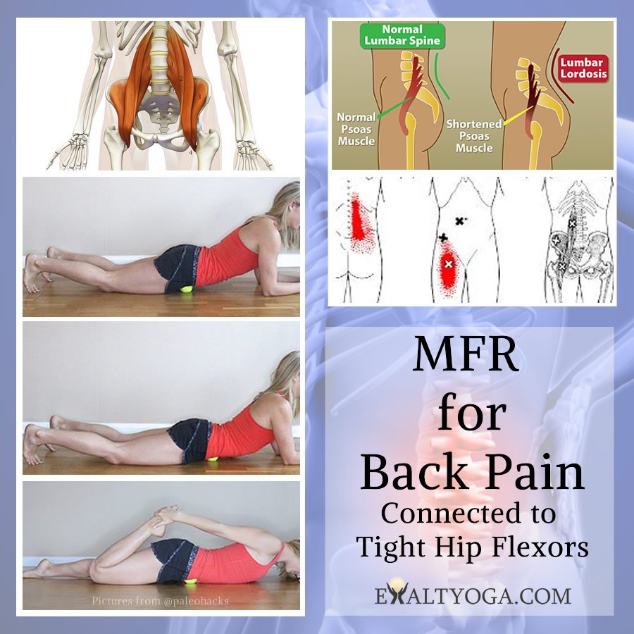 ExaltYoga's tweet photo. Tight hip flexors are a direct result of our sitting culture. As pictured, when the iliopsoas muscles become tight, they can pull on the low back causing pain. Self-MFR techniques, such as those pictured, can be a great way to release this tension! MFR Yoga, Sunday 12/17 @ 2:00! https://t.co/QcZGh8G8kB