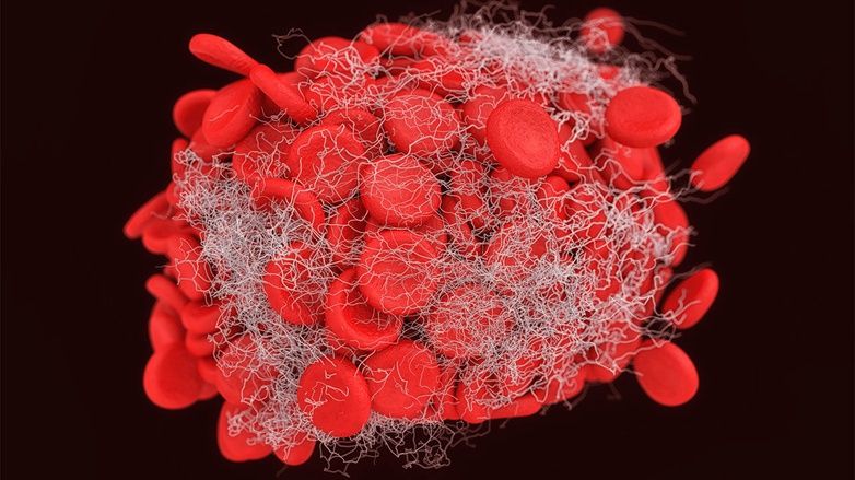 IAmBiotech's tweet image. Gene therapy stops bleeding episodes in #hemophilia trial buff.ly/2kNRDvJ