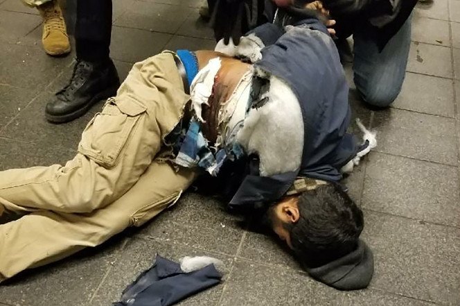 Sashtyani's tweet photo. اسمش "عقاید الله" هستش, همینطور که از اسمش پیداست یک تروریست مسلمان بنگلادشی ۲۷ ساله ساکن آمریکا که امروز کمربند انفجاریش قرار بود تو متروی نیویورک منفجر بشه که خوشبختانه زودتر از قرار و نصف و نیمه منفجر شد و خودش رو به این روز انداخت. https://t.co/j8v3QupUhQ