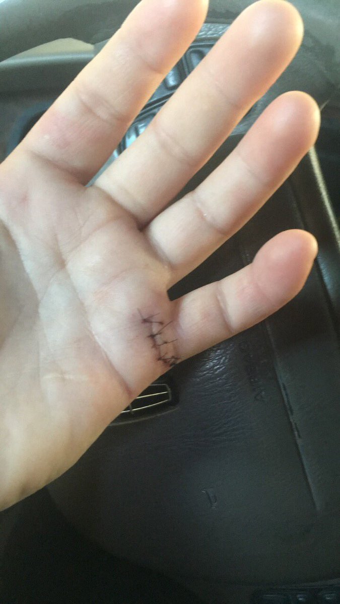 //So this happened last night.