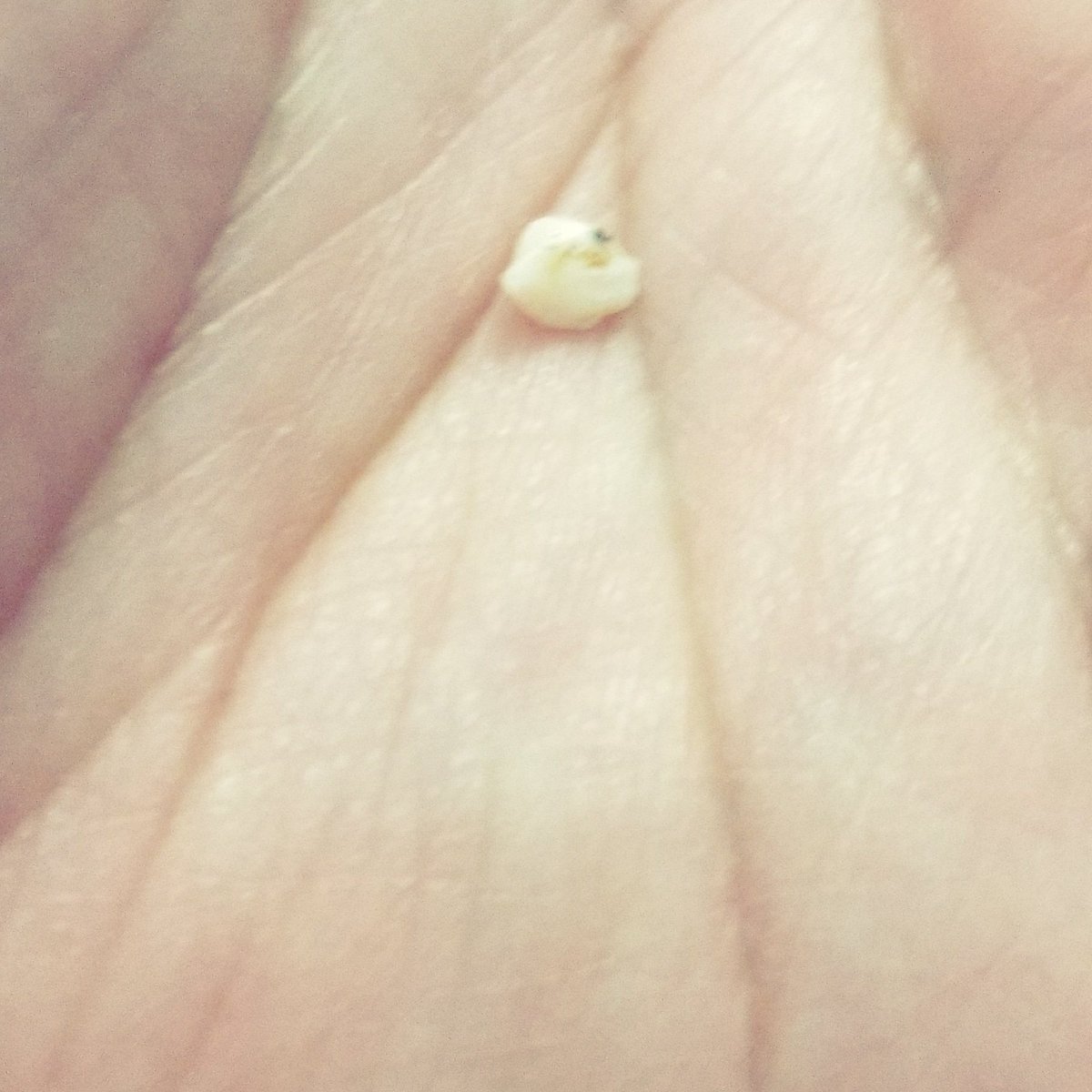 FrancesMFDanger's tweet photo. I'm going to put the chunk that broke off my #tooth under my pillow to see if the #ToothFairy pays up when they're #slightlyirregular. https://t.co/PtGi5hSjpU