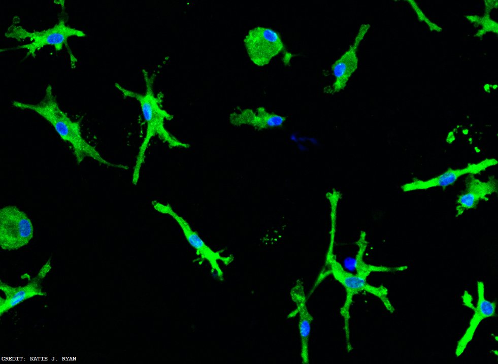 ScienceMagazine's tweet photo. In @ScienceTM: new cell culture methods could help researchers understand the role of microglia in neurodegenerative disease https://t.co/0r308mRMZM https://t.co/DI4u1SiMkr