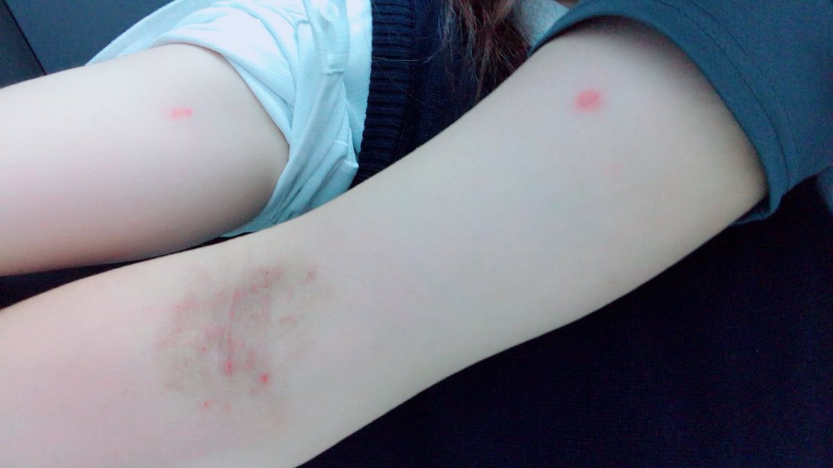 キスマークの付け方