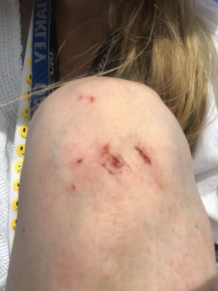 The good old Aussie all-terrain shoe. Not always the best choice for rock climbing.