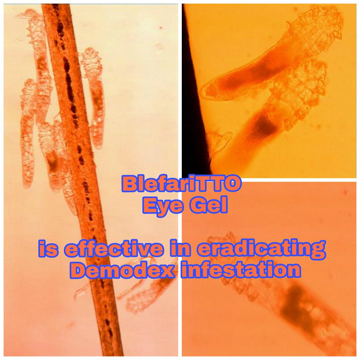 JEO on Twitter "Tea tree oil is the best effective way to treat and