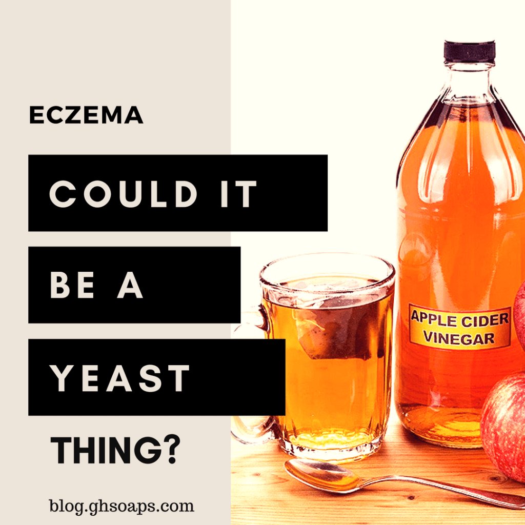 ghsoaps's tweet photo. Is Your Eczema Caused By Candida? https://t.co/C8Gi6Q8F6y https://t.co/JPNAmLG2du