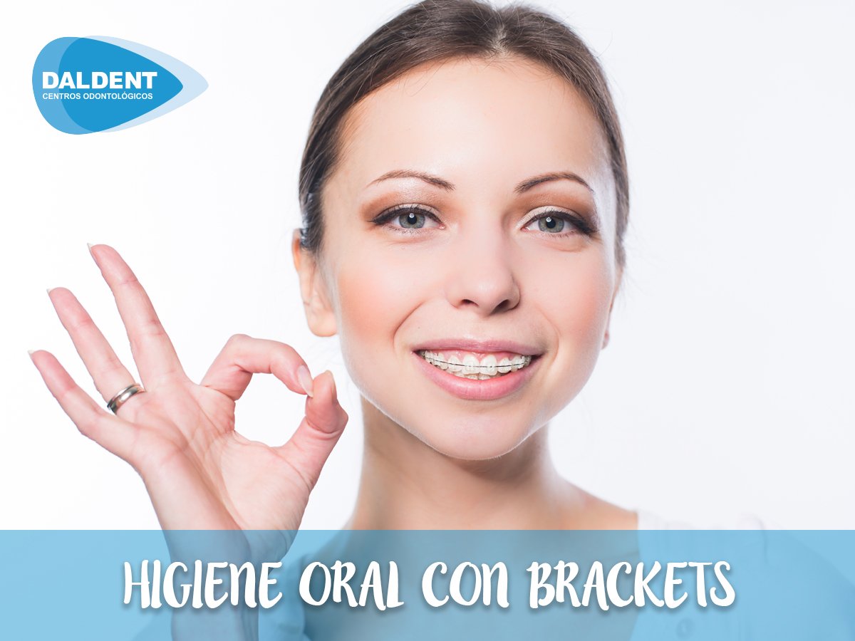 ¿Llevas brackets? Para conseguir los mejores resultados y cuidar de tus dientes durante el tratamiento, recuerda: 
➡️ Usa cepillos interdentales. 
➡️ Evita alimentos pegajosos como caramelos.
➡️ No utilices tus dientes como herramienta.
#Dentista #Sanchinarro #LasTablas