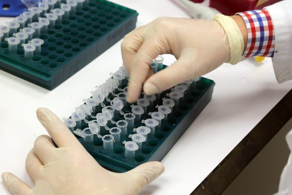 La terapia génica para algunas #EnfermedadesRaras monogénicas es casi una realidad.
efesalud.com/financiacion-f…
Pero...¿está preparada la administración para financiar estos #medicamentoshuerfanos? Jornada de <a href="/FEDER_ONG/">FEDER | Enfermedades Raras</a> y <a href="/aelmhu/">AELMHU</a> con <a href="/anisalud/">ANIS</a> y @CIBERER .