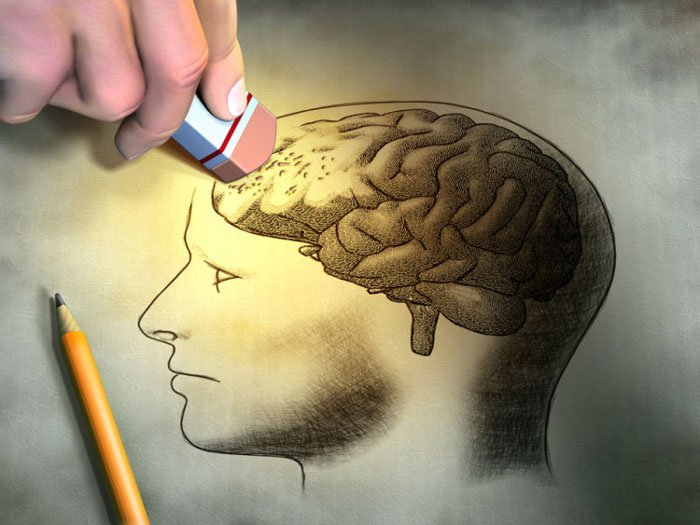 ¿Qué es lo que causa la demencia? -<a href="/MPcontrol_/">MPcontrol</a> 
bit.ly/2jUfMgJ