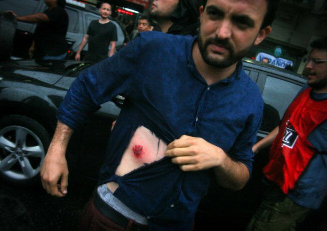 nicocarvalholp's tweet photo. Mi abrazo y solidaridad para @leogrosso @pietragallahora y todos los compañeros reprimidos ayer. Hoy, todos a resistir este robo  #NoALaReformaPrevisional. @JPVLaPlata https://t.co/nG2P8g651y