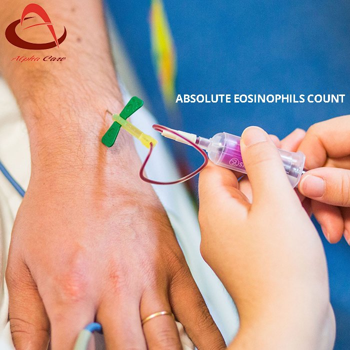 alphacarelab's tweet photo. If You Need a ECG, Blood Test Check-Up?
🔺 Just Make an Appointment  ☎️☎️  9841537468 
🔻 Opening Hours  Mon-sat [7.00am - 6.00pm]
 Visit Our Site@  https://t.co/iDFnPVgWZe
#ECG #blood #bloodtest #checkup #medical #medicaltreatment #health  #gudalur #nilgiris #laboratory https://t.co/ezRPQsX2zA