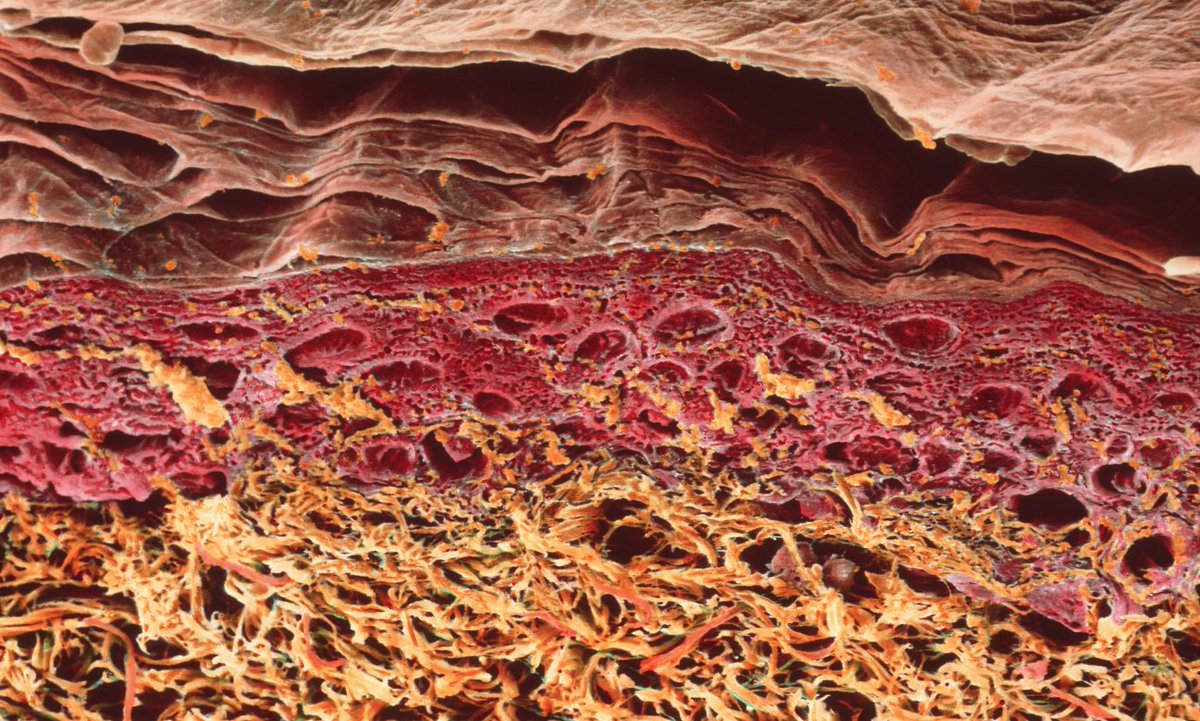 PourlaScience's tweet photo. La peau d'un patient a été régénérée à l'aide de cellules souches https://t.co/ZYagQvxdmb https://t.co/OAWxPuSdCP