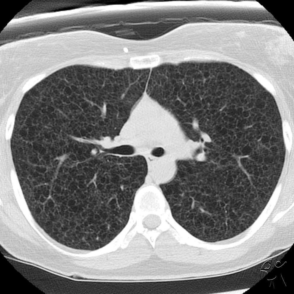 CincyKidsRad tweet picture