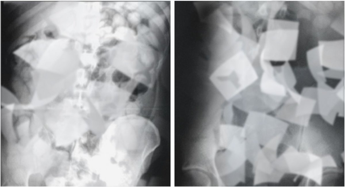 elmundotoday's tweet image. La Guardia Civil detienen en el aeropuerto a dos narcotraficantes con 200 hipotecas a tipo fijo ocultas en el recto buff.ly/2o3p3aT