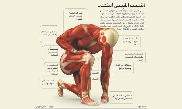 أعراض التصلب اللويحي في الوجه