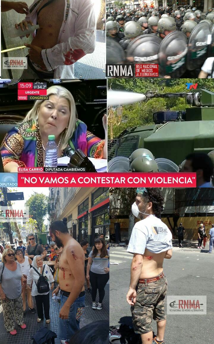 rmalternativos's tweet photo. #AHORA #LaPlata #ArgentinaMilitarizada Un modelo que sin represión, no entra. Hay varios fotógrafos y periodistas con múltiples impactos de balas de goma.
#ReformaLaboral #ReformaTributaria y #ReformaPrevisional
👇👇👇👇 https://t.co/WOmaMz6jMD