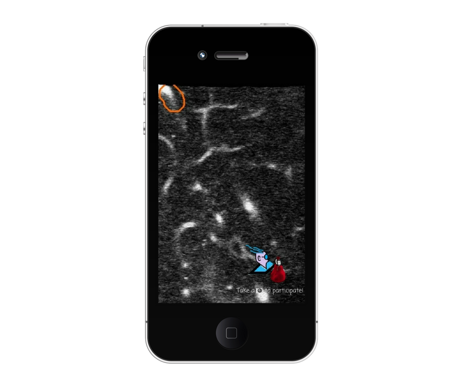 SciCatchers's tweet photo. #CatchXmas Day 1 has passed, 11 days to go till #Xmas!! Did you find our "bearing gifts" hidden catcher yet?! Send us a screenshot if you do - you're in for prizes!! 🎁🎄

#StallCatchers #citizenscience #citsci #citscigames #XmasGifts #XmasCountdown2017 https://t.co/lq7r0p78j1