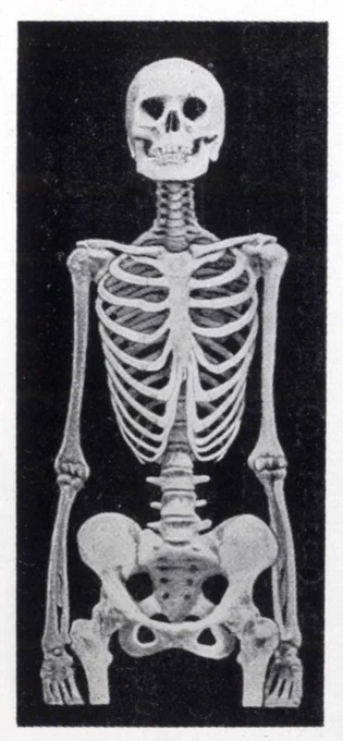 @akutsuhirohiko 標本写真だと側弯がないんですが、図だと側弯で描かれていることが多いです。結核で亡くなった若い女性の骨格標本。19世紀ごろ。シュトラッツ『女体美大系』より。 