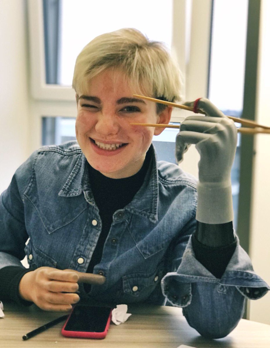 VioBebe's tweet photo. La tecnologia sta facendo passi da gigante... finalmente ho imparato ad usare le bacchette! 🥢👌🏼 🍣💕
#touchbionics
#RoadToTokyo @Tokyo2020 https://t.co/aqFaJfQEyF